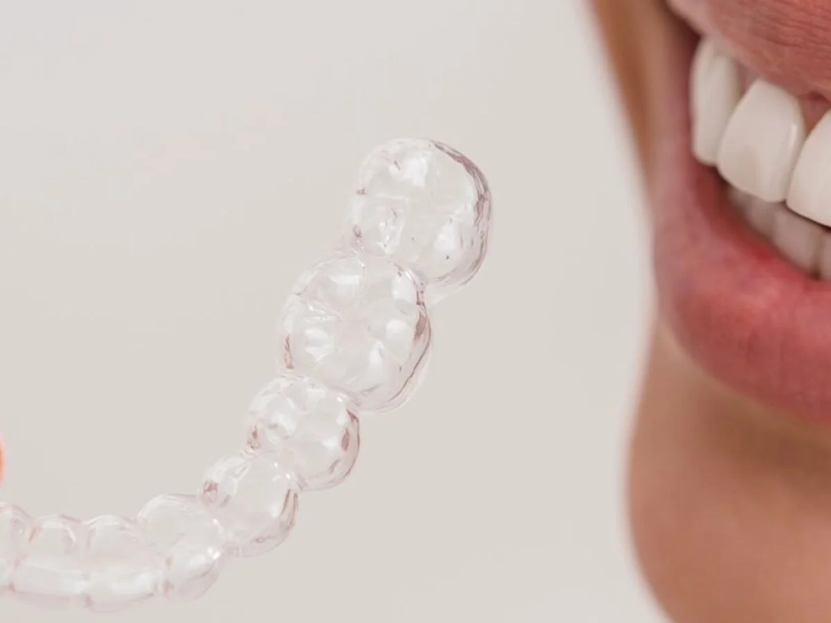 Invisalign: Crafting Lasting Smile Harmony with Precision Aligners